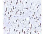 SCF Antibody in Immunohistochemistry (Paraffin) (IHC (P))