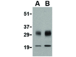 SCO1 Antibody in Western Blot (WB)