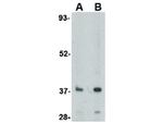 SCRAPPER Antibody in Western Blot (WB)