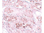 SCRN1 Antibody in Immunohistochemistry (Paraffin) (IHC (P))
