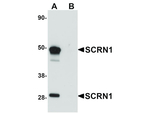 SCRN1 Antibody in Western Blot (WB)