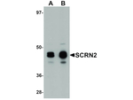 SCRN2 Antibody in Western Blot (WB)