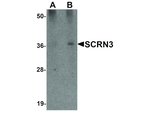 SCRN3 Antibody in Western Blot (WB)