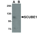 SCUBE1 Antibody in Western Blot (WB)