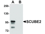 SCUBE2 Antibody in Western Blot (WB)