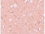 SESTD1 Antibody in Immunohistochemistry (Paraffin) (IHC (P))