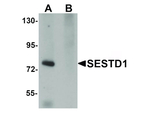 SESTD1 Antibody in Western Blot (WB)