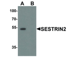 SESTRIN2 Polyclonal Antibody