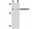 SHOC2 Antibody in Western Blot (WB)