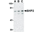 SHP2 Polyclonal Antibody