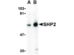 SHP2 Antibody in Western Blot (WB)