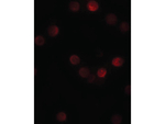 SIP1 Antibody in Immunocytochemistry (ICC/IF)