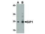 SIP1 Antibody in Western Blot (WB)
