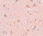 SIPA1L1 Antibody in Immunohistochemistry (Paraffin) (IHC (P))