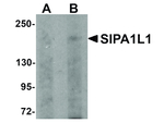 SIPA1L1 Antibody in Western Blot (WB)