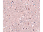 SIPA1L2 Antibody in Immunohistochemistry (Paraffin) (IHC (P))