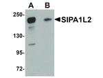 SIPA1L2 Antibody in Western Blot (WB)