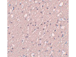 SIPA1L3 Antibody in Immunohistochemistry (Paraffin) (IHC (P))