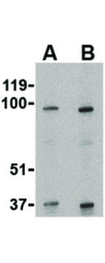 SKI Antibody in Western Blot (WB)