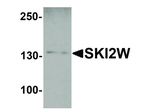 SKI2W Polyclonal Antibody