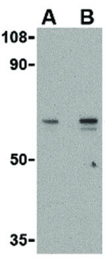 SkiP Antibody in Western Blot (WB)