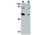 Slc22A17 Antibody in Western Blot (WB)