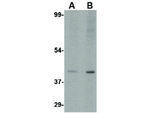 Slc35D1 Polyclonal Antibody