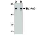 Slc37A2 Antibody in Western Blot (WB)