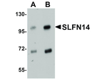 SLFN14 Antibody in Western Blot (WB)
