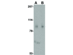Slitrk1 Antibody in Western Blot (WB)