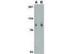 Slitrk1 Antibody in Western Blot (WB)