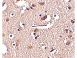 Slitrk2 Antibody in Immunohistochemistry (Paraffin) (IHC (P))