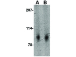 Slitrk2 Antibody in Western Blot (WB)