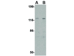 Slitrk3 Antibody in Western Blot (WB)
