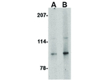 Slitrk4 Antibody in Western Blot (WB)