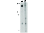 Slitrk5 Antibody in Western Blot (WB)