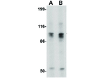 Slitrk6 Antibody in Western Blot (WB)