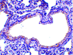 SLPI Polyclonal Antibody
