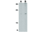 SLPI Antibody in Western Blot (WB)