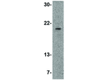 SLPI Polyclonal Antibody
