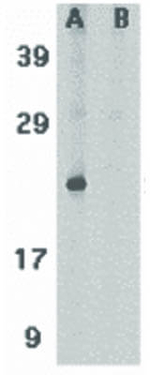 Smac Antibody in Western Blot (WB)