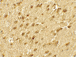 SMARCA4 Polyclonal Antibody