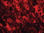 SMARCA4 Antibody in Immunohistochemistry (Paraffin) (IHC (P))