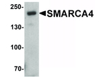 SMARCA4 Antibody in Western Blot (WB)