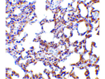 SnoN Antibody in Immunohistochemistry (Paraffin) (IHC (P))