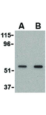 SnoN Antibody in Western Blot (WB)
