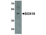 SOX18 Polyclonal Antibody