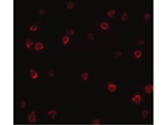 SOX2 Antibody in Immunocytochemistry (ICC/IF)