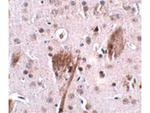 SPG11 Polyclonal Antibody