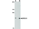 SPG11 Antibody in Western Blot (WB)